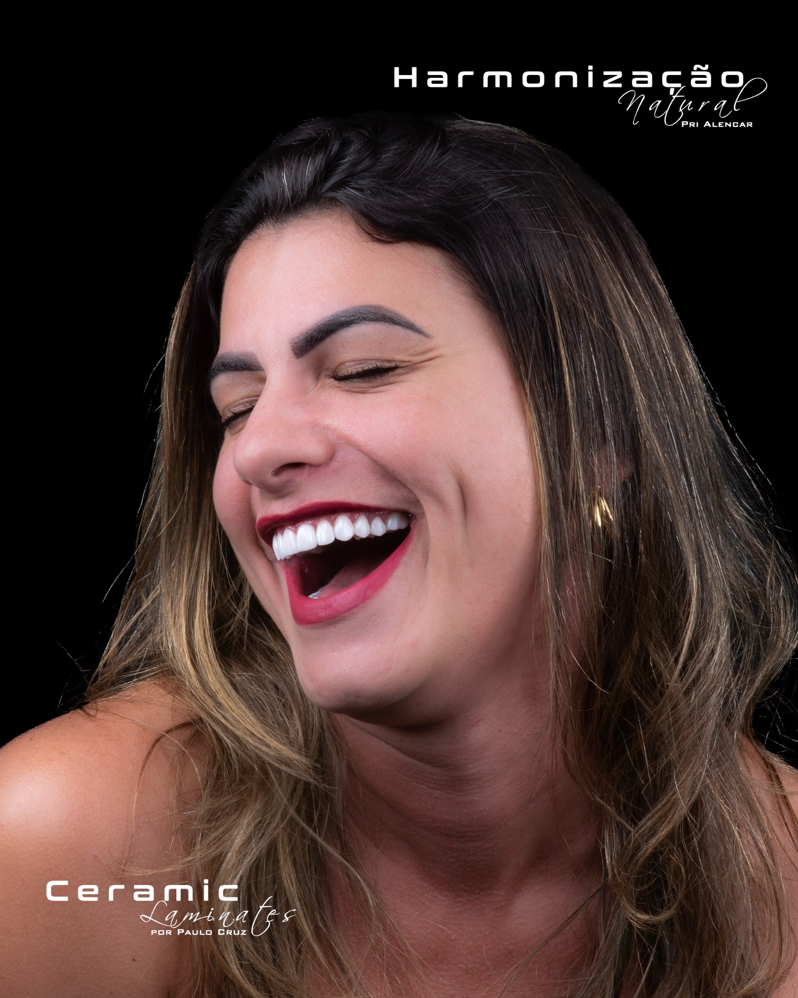 Sorriso natural