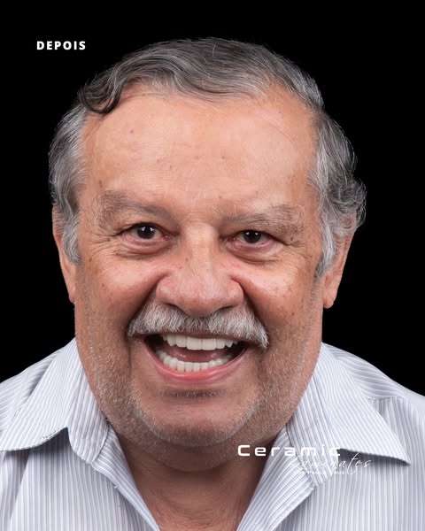Caso clínico 2 depois