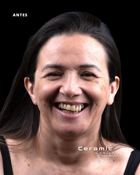 Caso clínico 3 antes